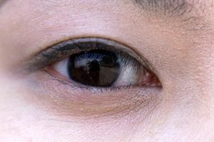 2025年最新！新宿の糸リフト施術で理想のフェイスラインを実現する完全ガイド