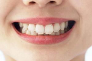 太田母斑治療の新常識！レーザー治療で自信を取り戻す方法とは